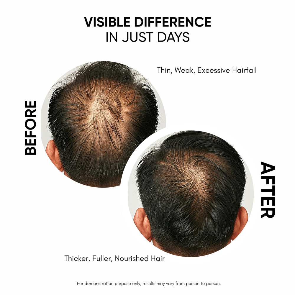 Masofta serum ingredients visual with Redensyl Anagain Capixyl suggests advanced hair growth support
