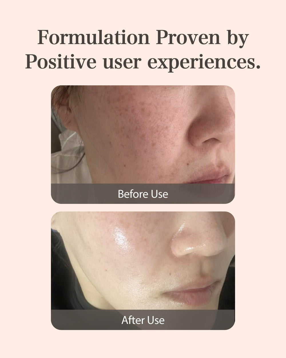 Mastina Niacinamide 5% supports visibly healthier skin texture.