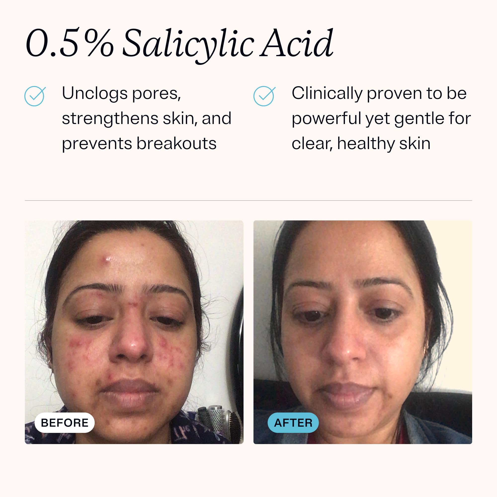 MDacne Hydrating Cleanser ingredients featuring Vitamin E and Green Tea for hydration.