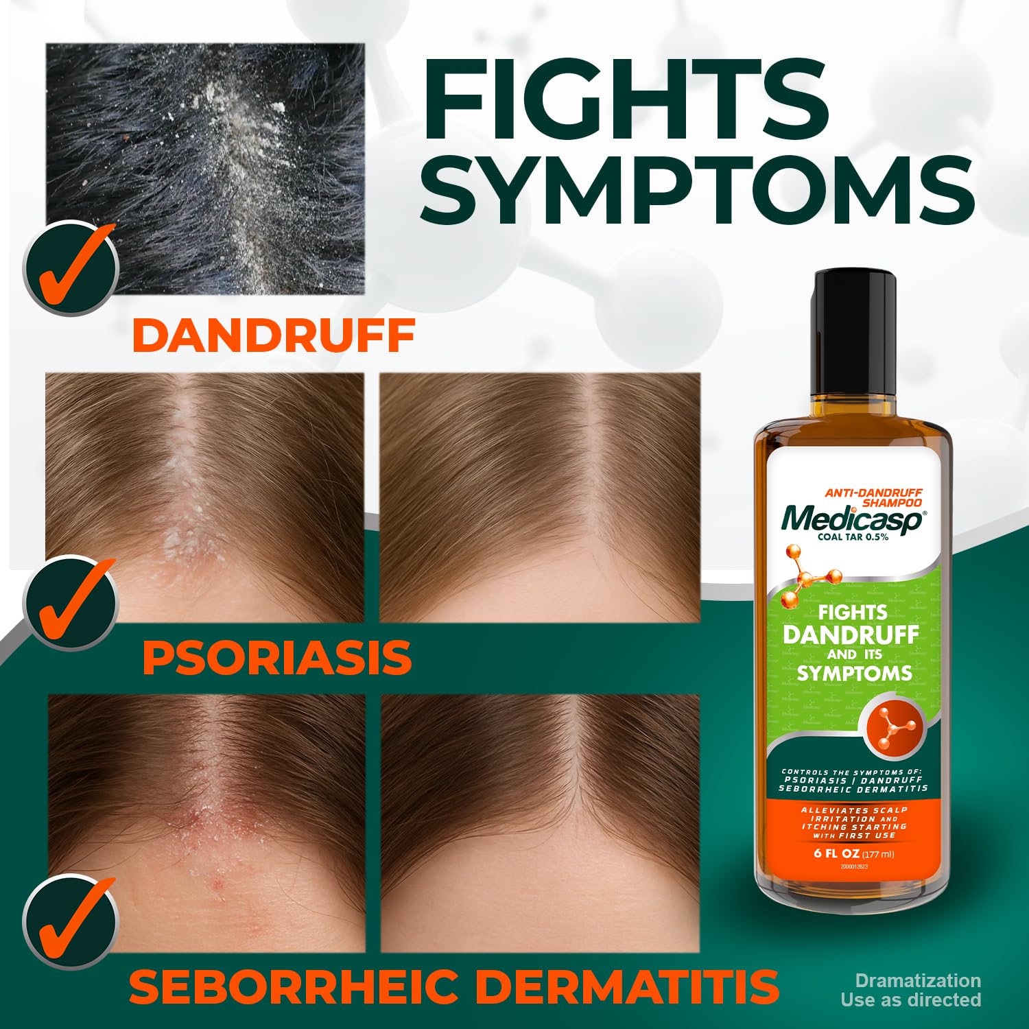 Medicasp coal tar anti-dandruff shampoo application image demonstrates how to apply to the scalp during cleansing.