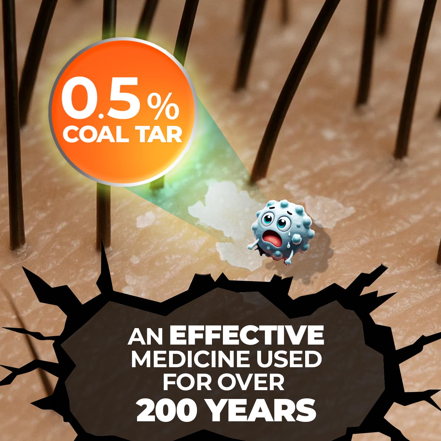 Medicasp coal tar anti-dandruff shampoo label close-up highlights root-cause focus for ongoing relief.