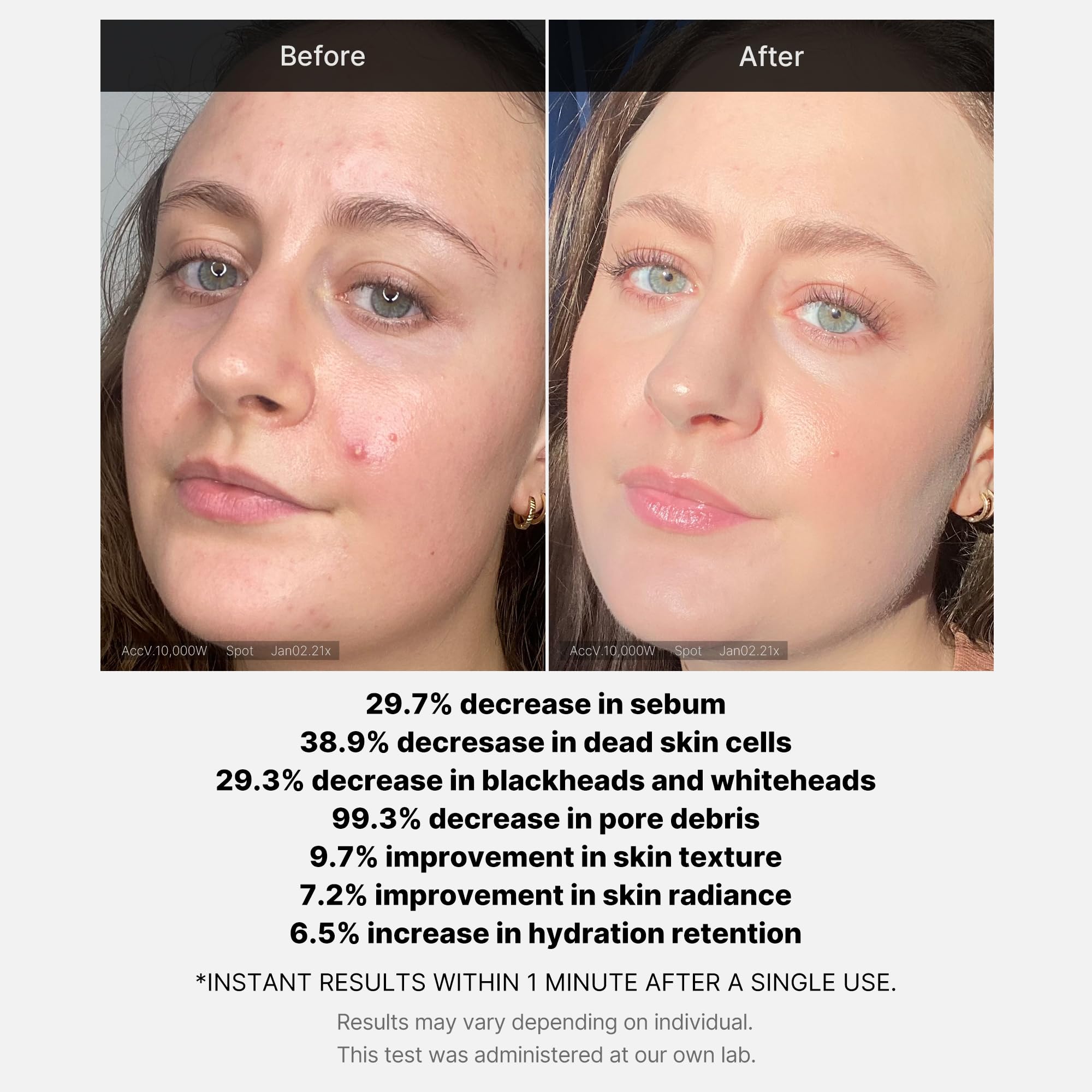 Medicube patch-test reminder for sensitive skin before exfoliant use.