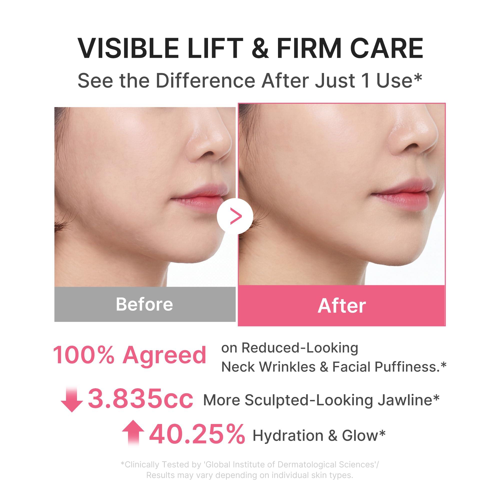 medicube application demonstration on neck to show contouring benefit