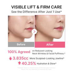 medicube application demonstration on neck to show contouring benefit