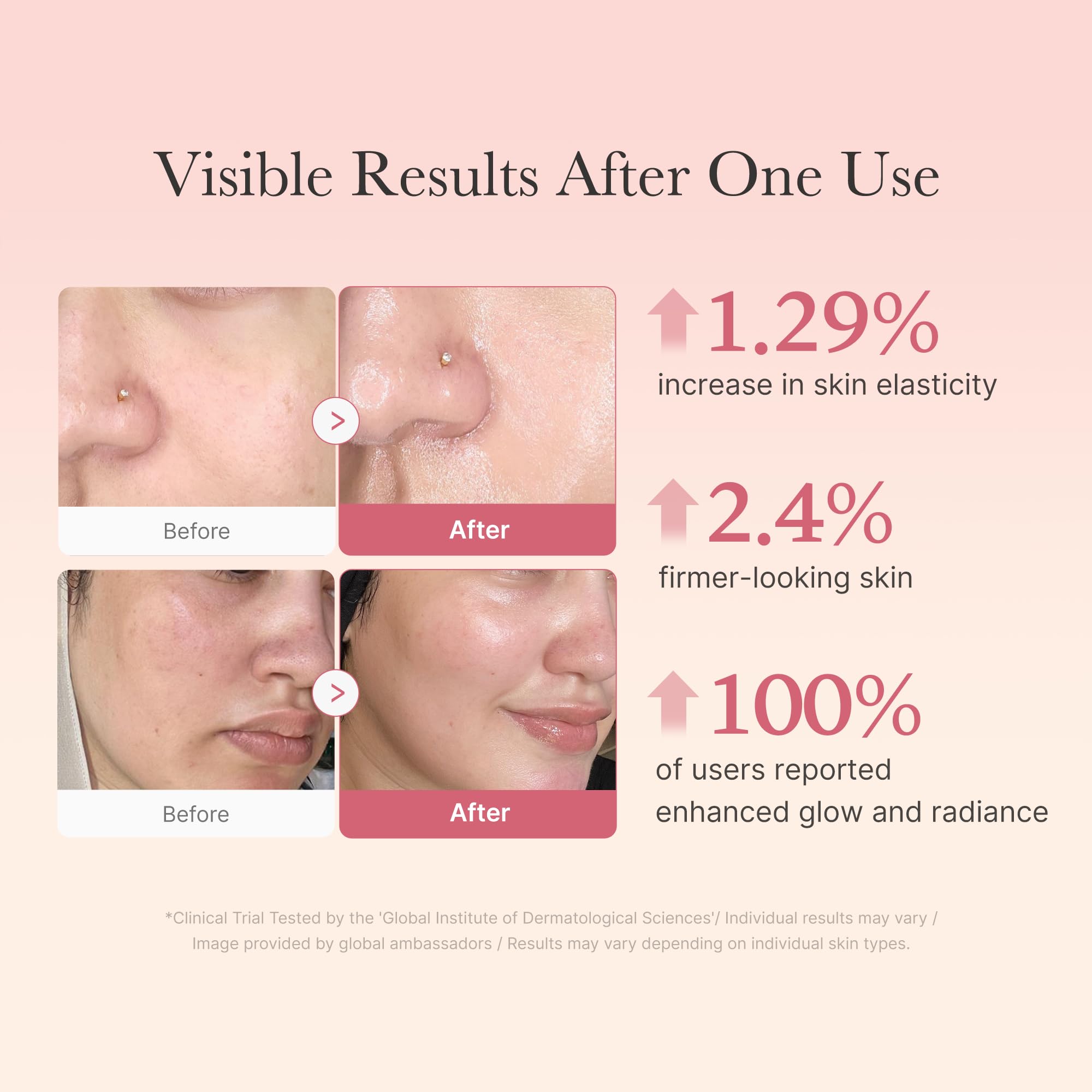 Medicube Collagen Jelly Cream neck-decolletage application highlights targeted hydration for decolletage.