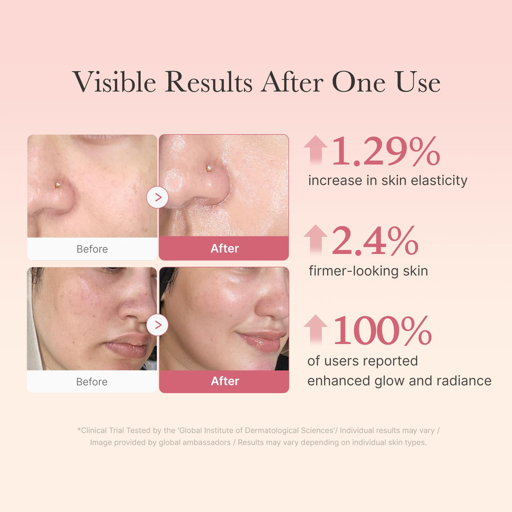 Medicube Collagen Jelly Cream neck-decolletage application highlights targeted hydration for decolletage.
