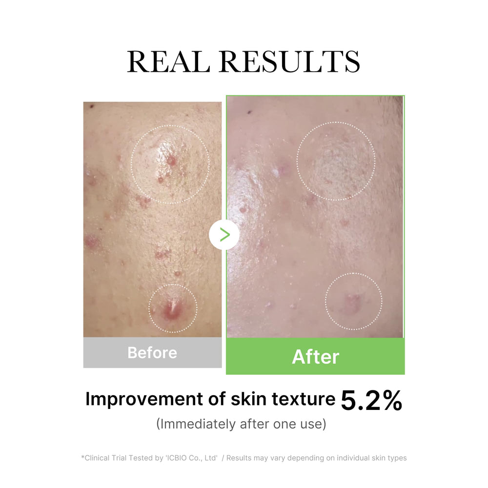 Medicube Exosome Cica Tea Tree Ampoule clinical-trial badge indicating tested soothing performance.