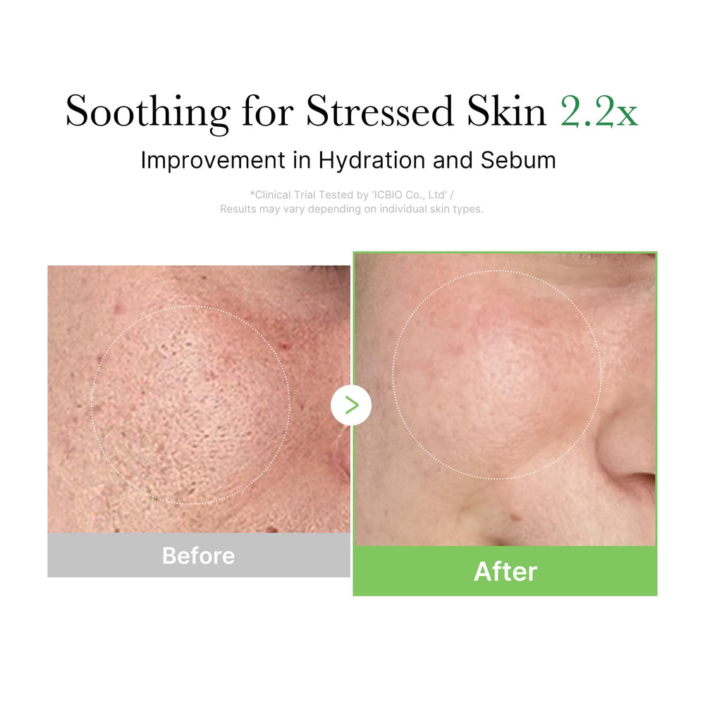 Medicube Exosome Cica Tea Tree Cream centella asiatica boosts calming care.