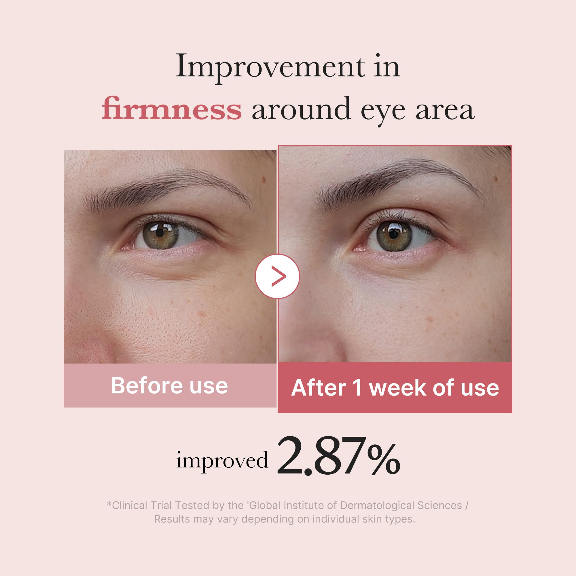Medicube eye area closeup reveals improved hydration around the eye area.