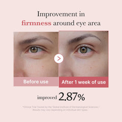 Medicube eye area closeup reveals improved hydration around the eye area.