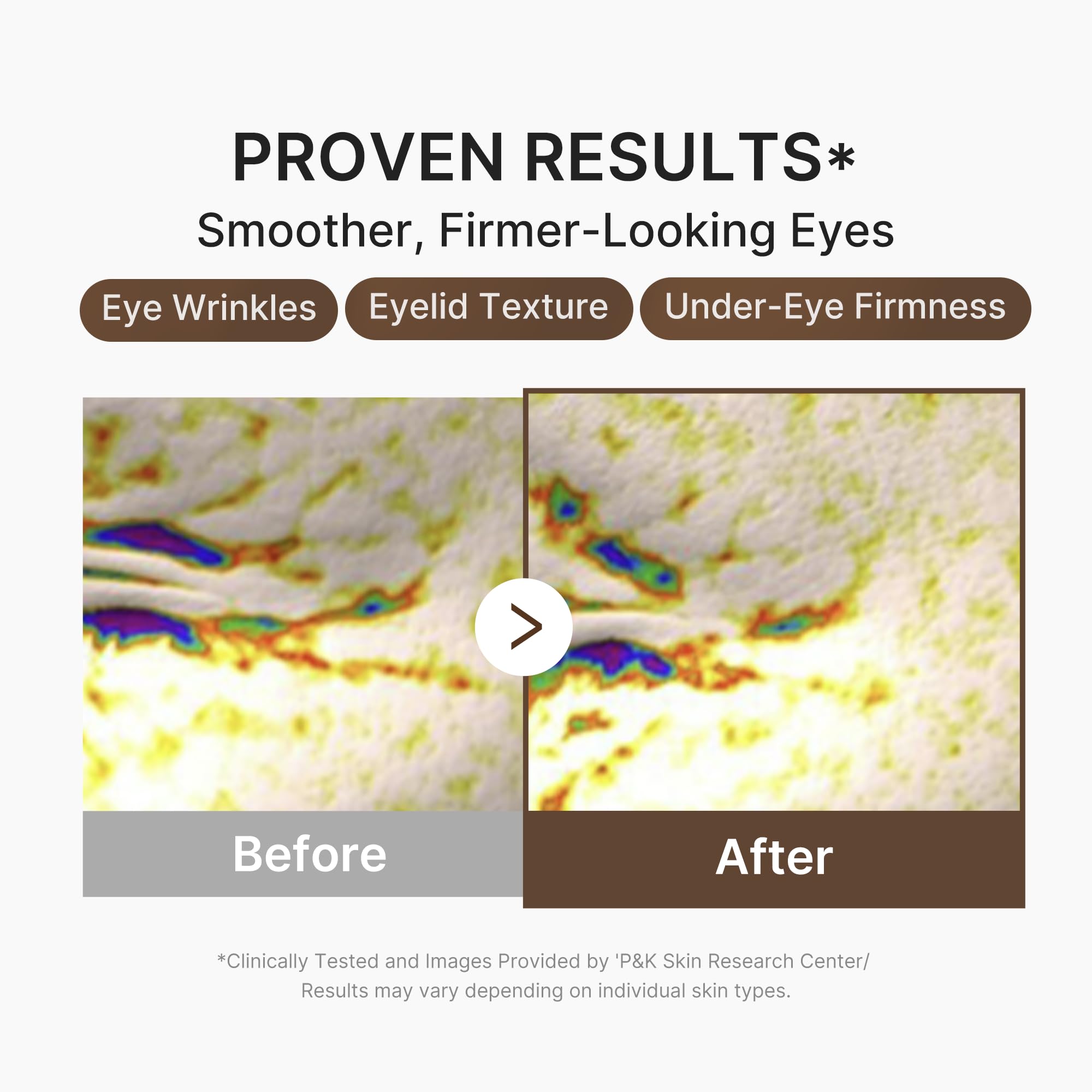 medicube serum applied under eye demonstrating smoothing benefit