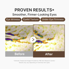 medicube serum applied under eye demonstrating smoothing benefit