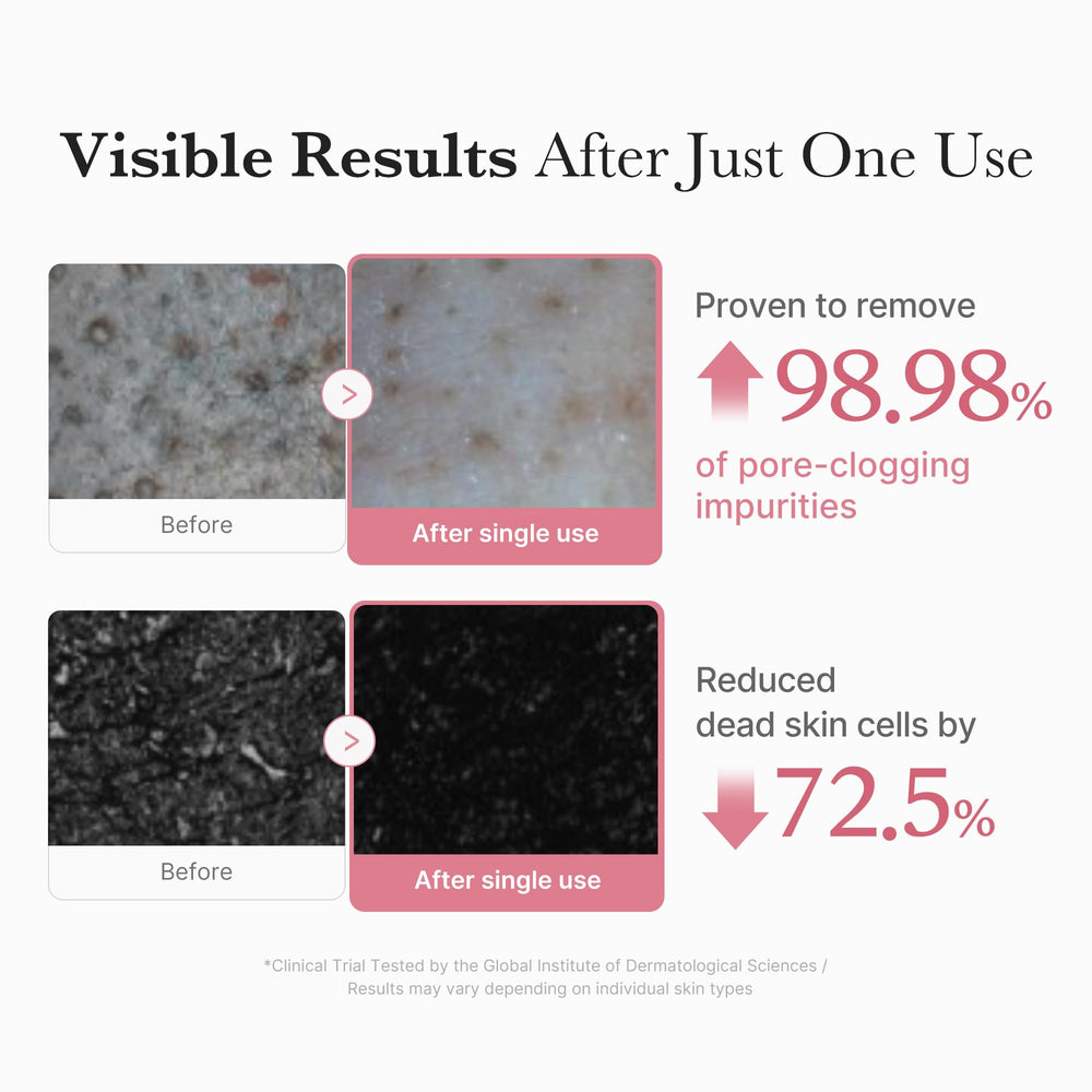 Medicube PDRN ceramides moisture-barrier close-up emphasizes protective hydration.