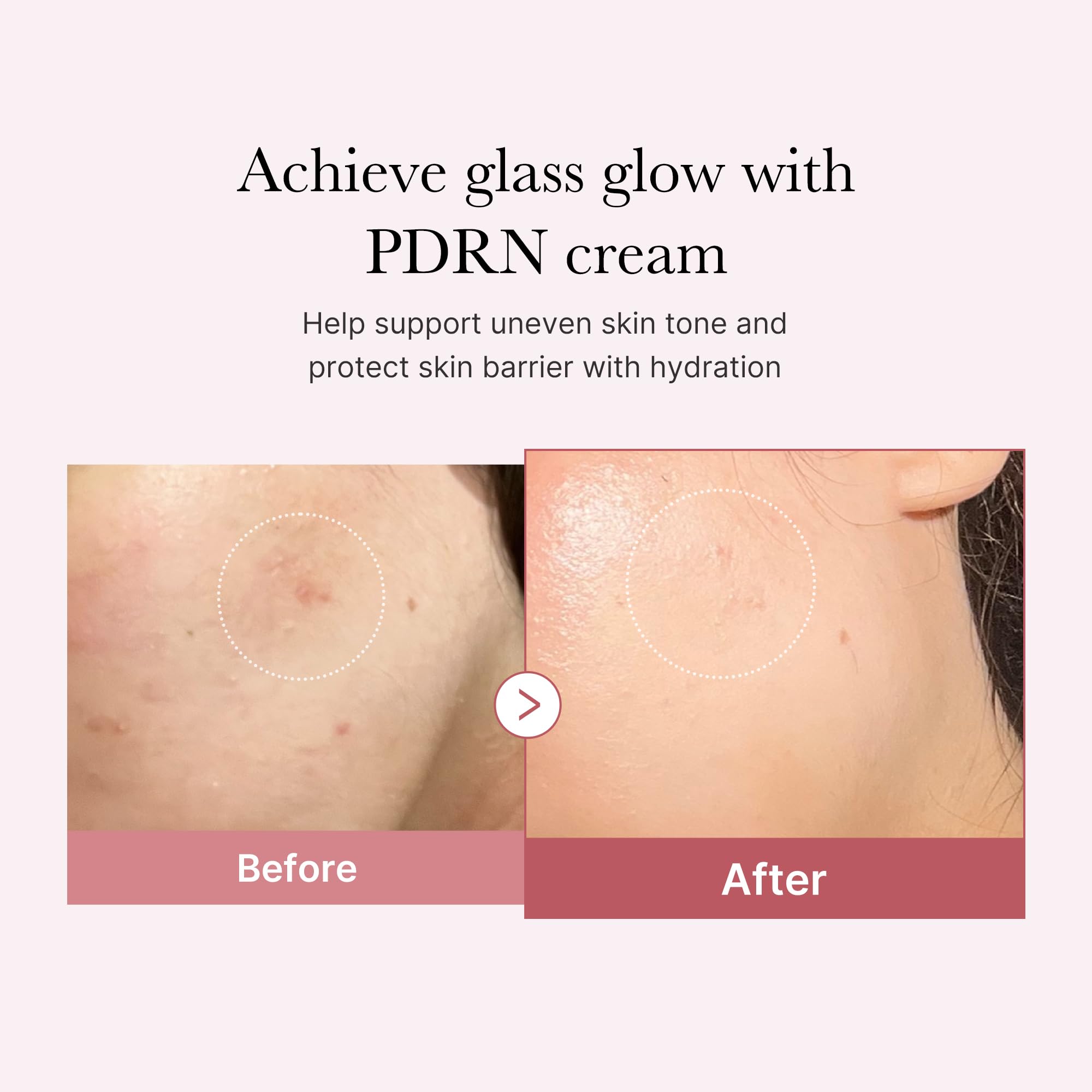 Medicube PDRN Pink Hyaluronic Cream texture closeup highlights lighter, non-greasy relief.