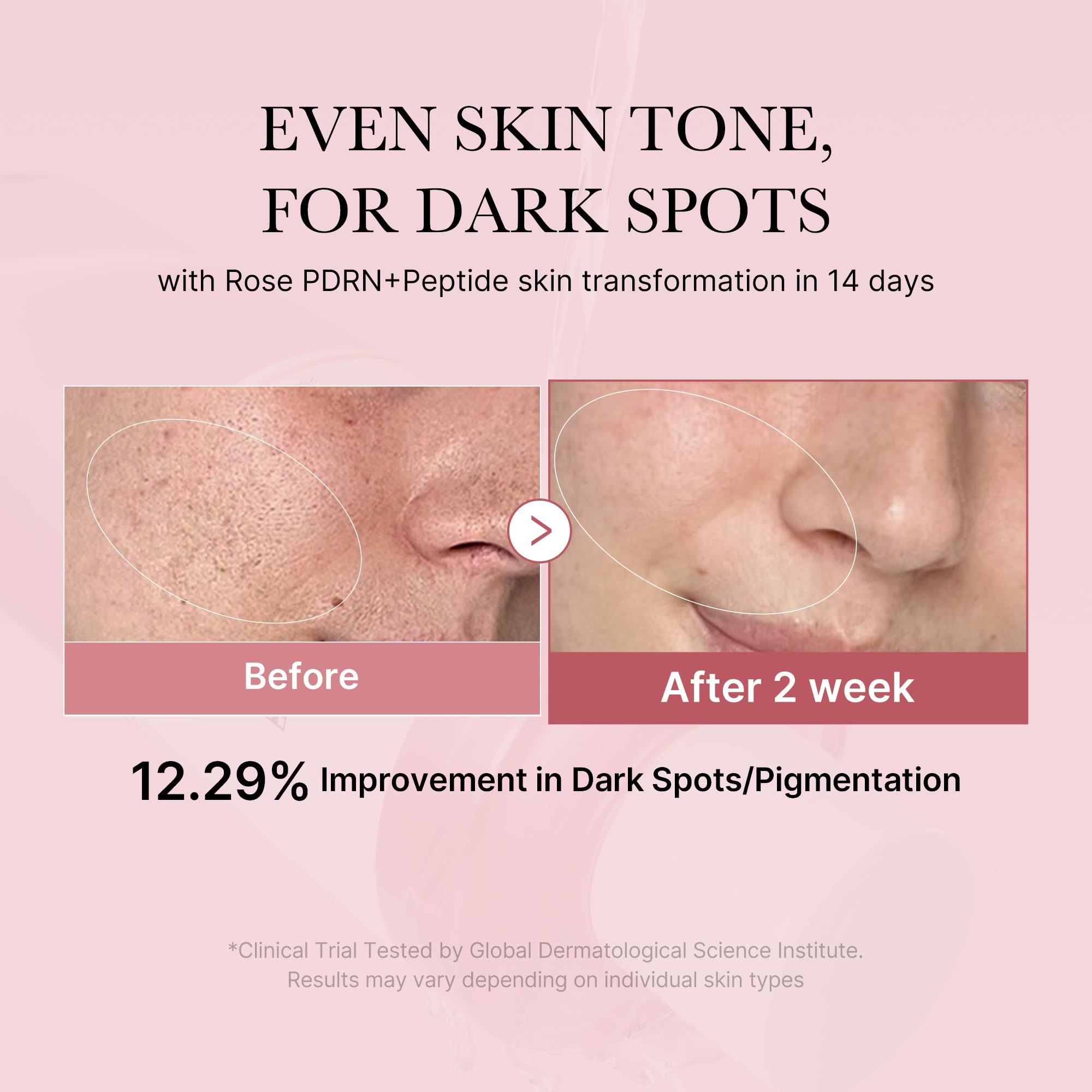 Medicube PDRN Pink toner close-up emphasizes rose PDRN benefits.