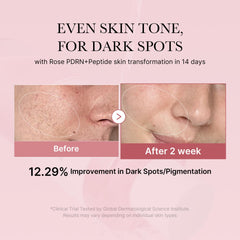 Medicube PDRN Pink toner close-up emphasizes rose PDRN benefits.