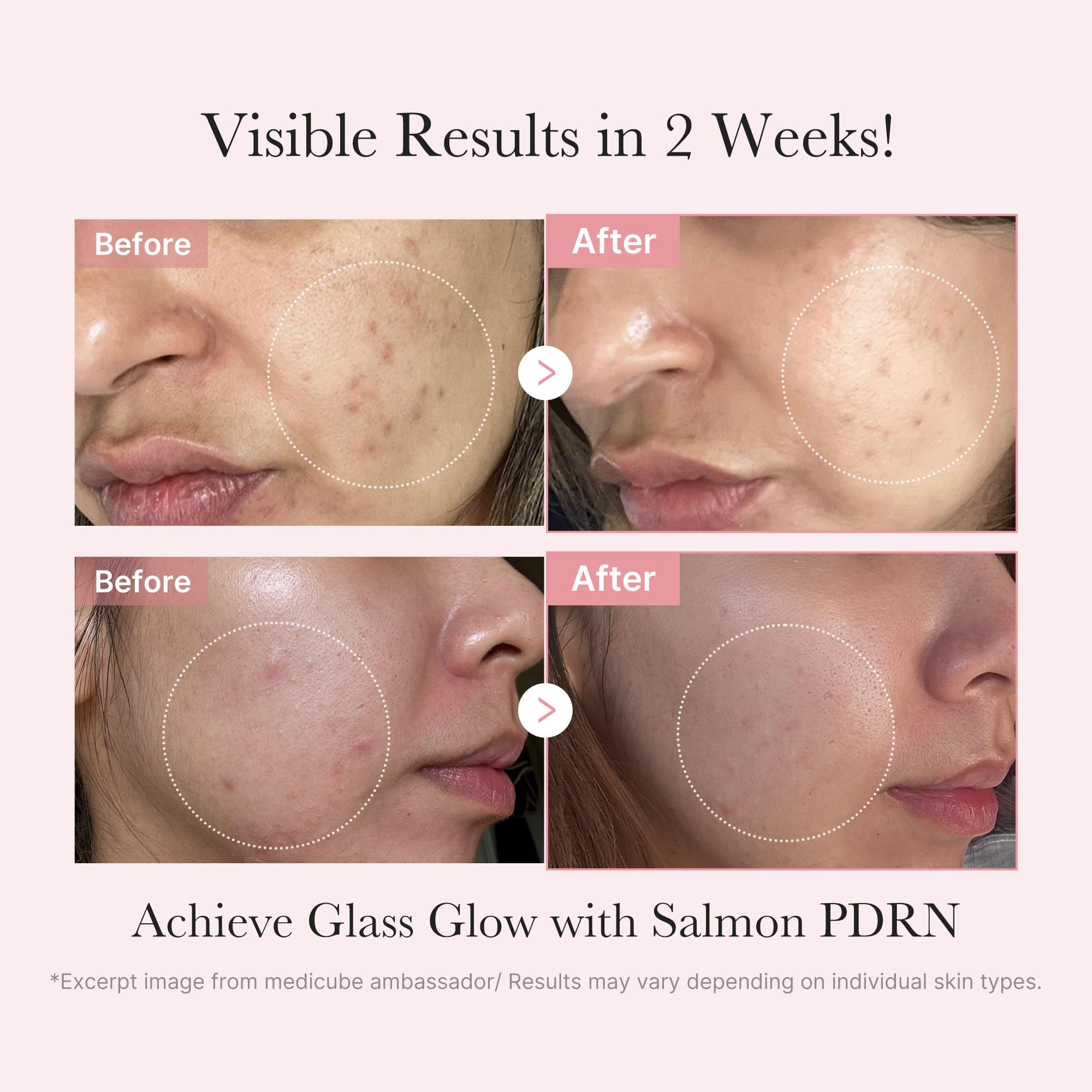 Medicube Pink Vita Coating Mask packaging emphasizes deep hydration and even tone