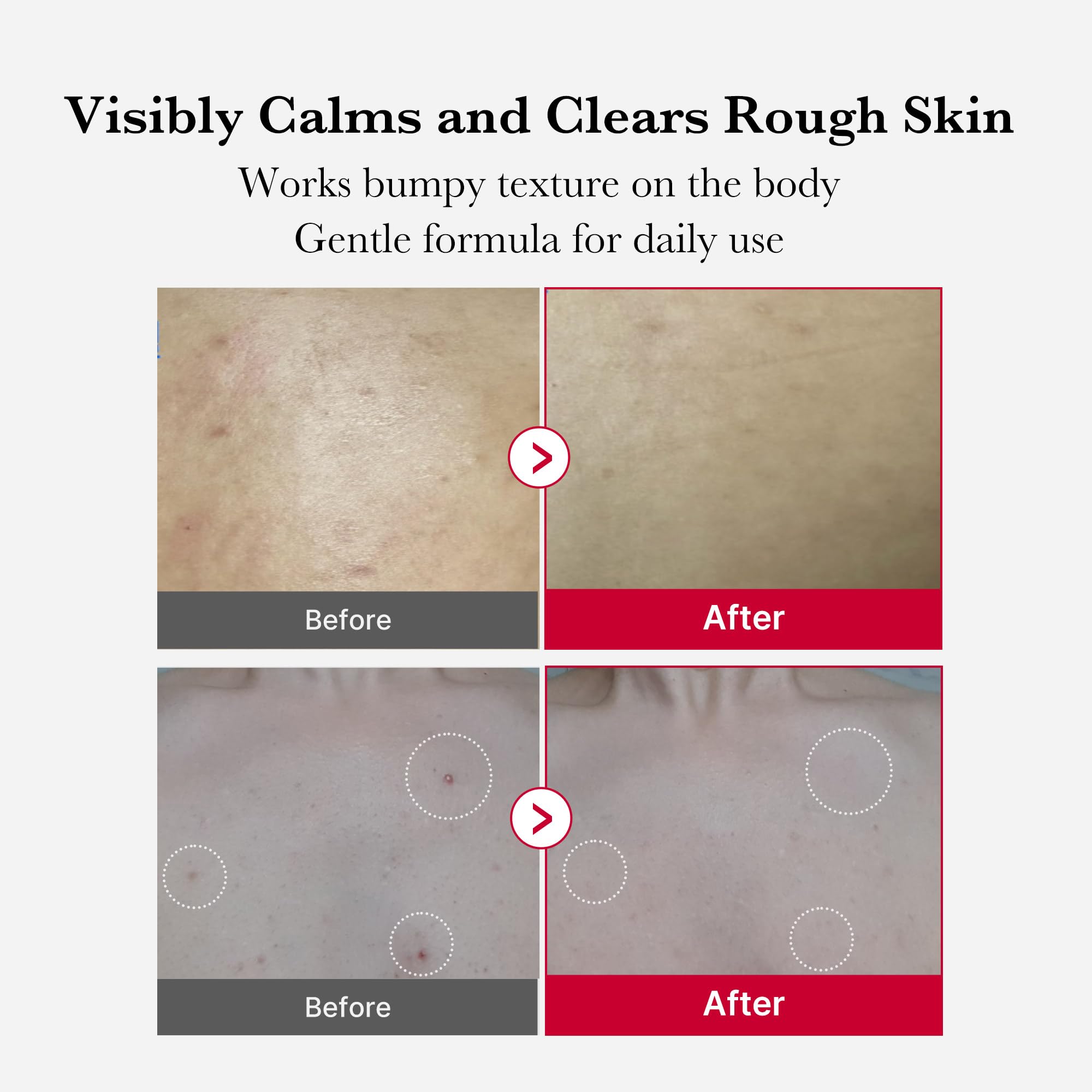 medicube Red Body Peeling Shot packaging on a bathroom shelf for summer skincare.
