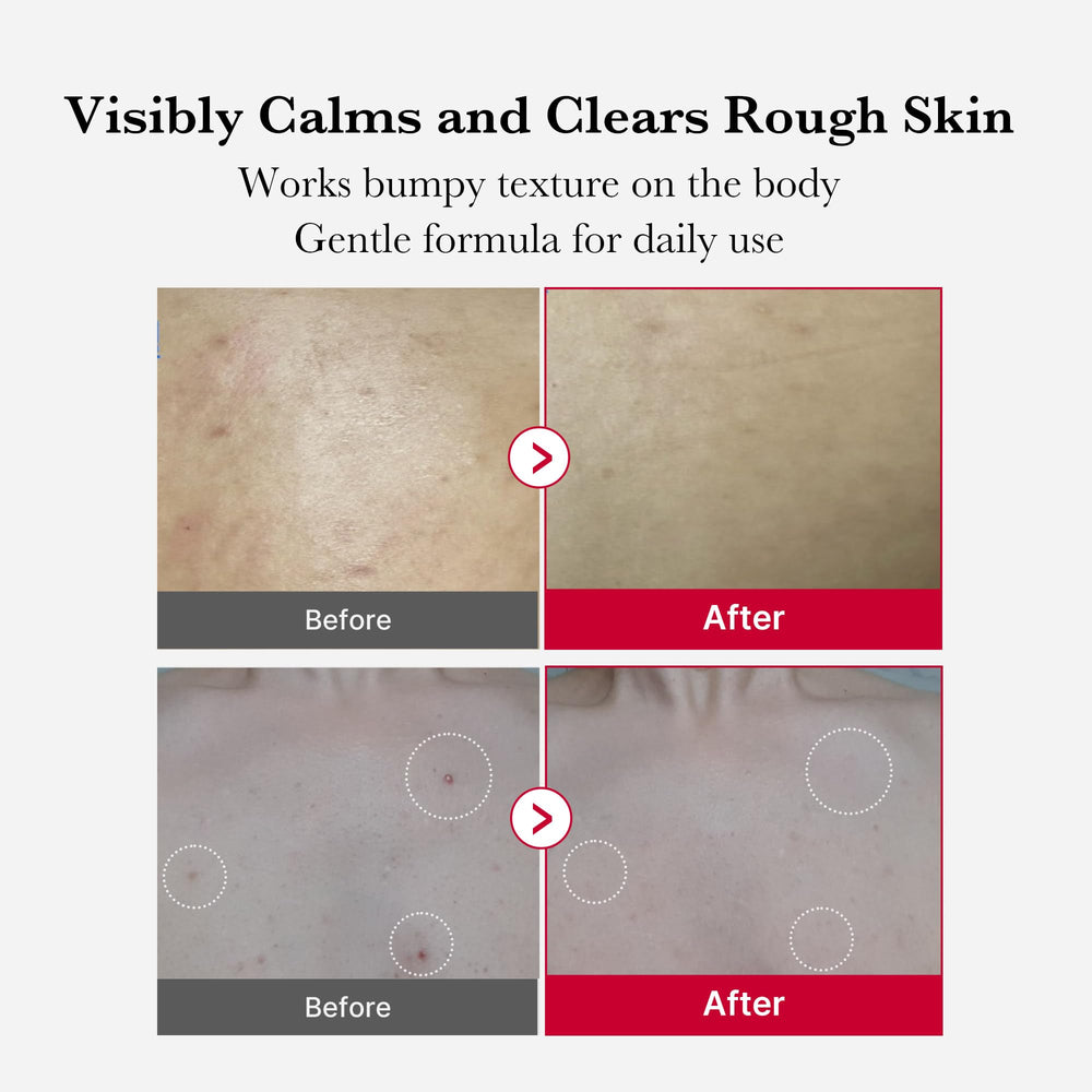 medicube Red Body Peeling Shot packaging on a bathroom shelf for summer skincare.