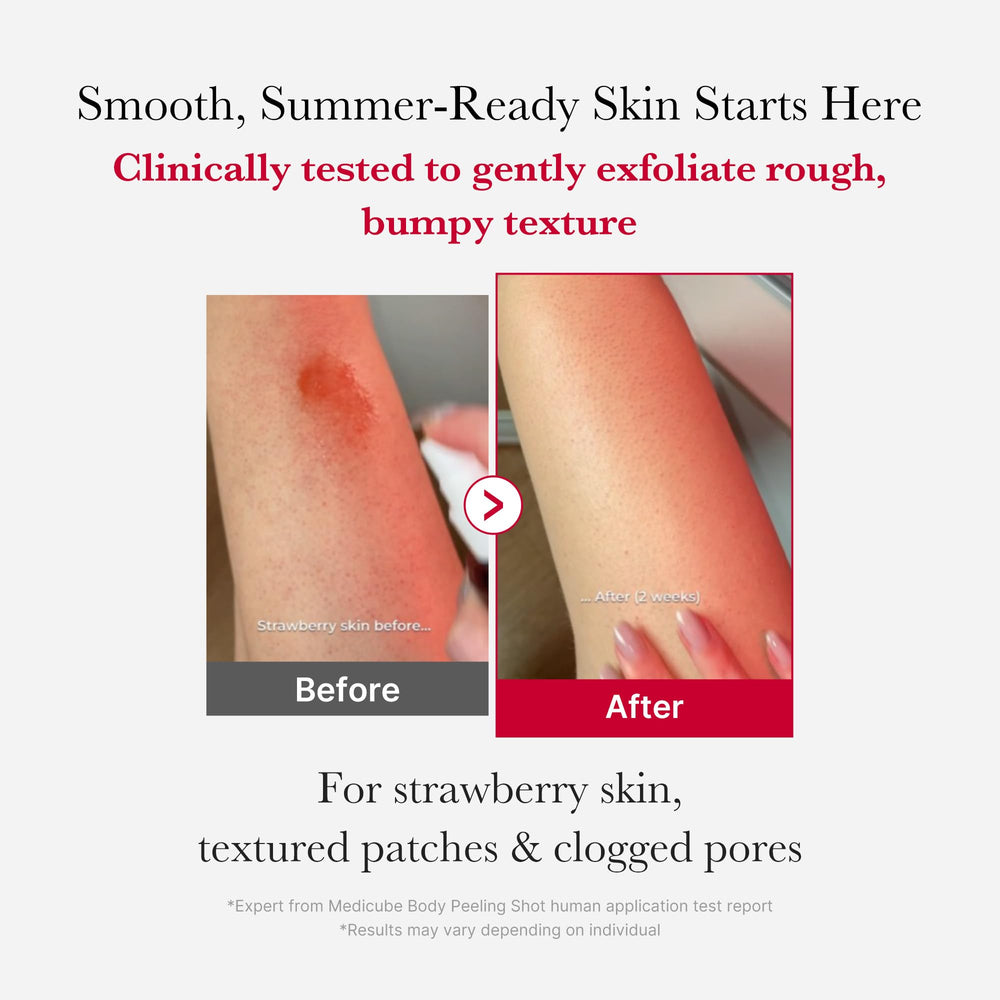 medicube Red Body Peeling Shot spray in use for targeted back exfoliation.