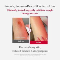 medicube Red Body Peeling Shot spray in use for targeted back exfoliation.