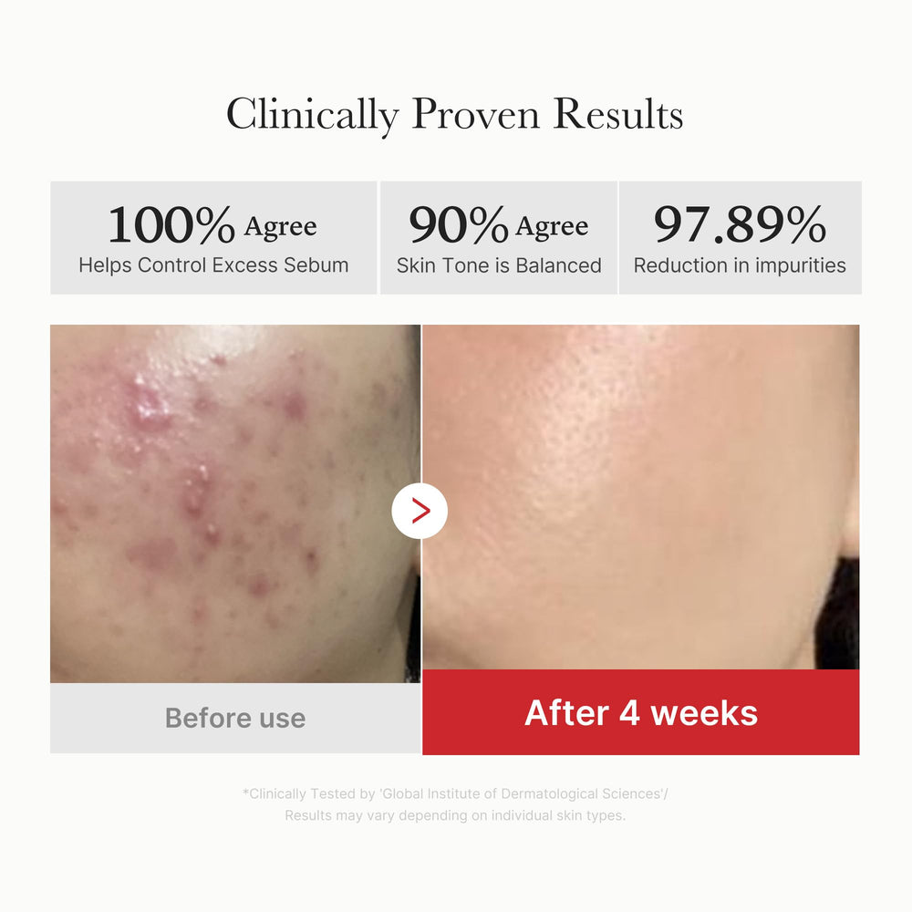 Medicube Red Succinic Panthenol Pad texture scene suggests effective dead-skin cell removal.