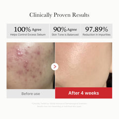 Medicube Red Succinic Panthenol Pad texture scene suggests effective dead-skin cell removal.