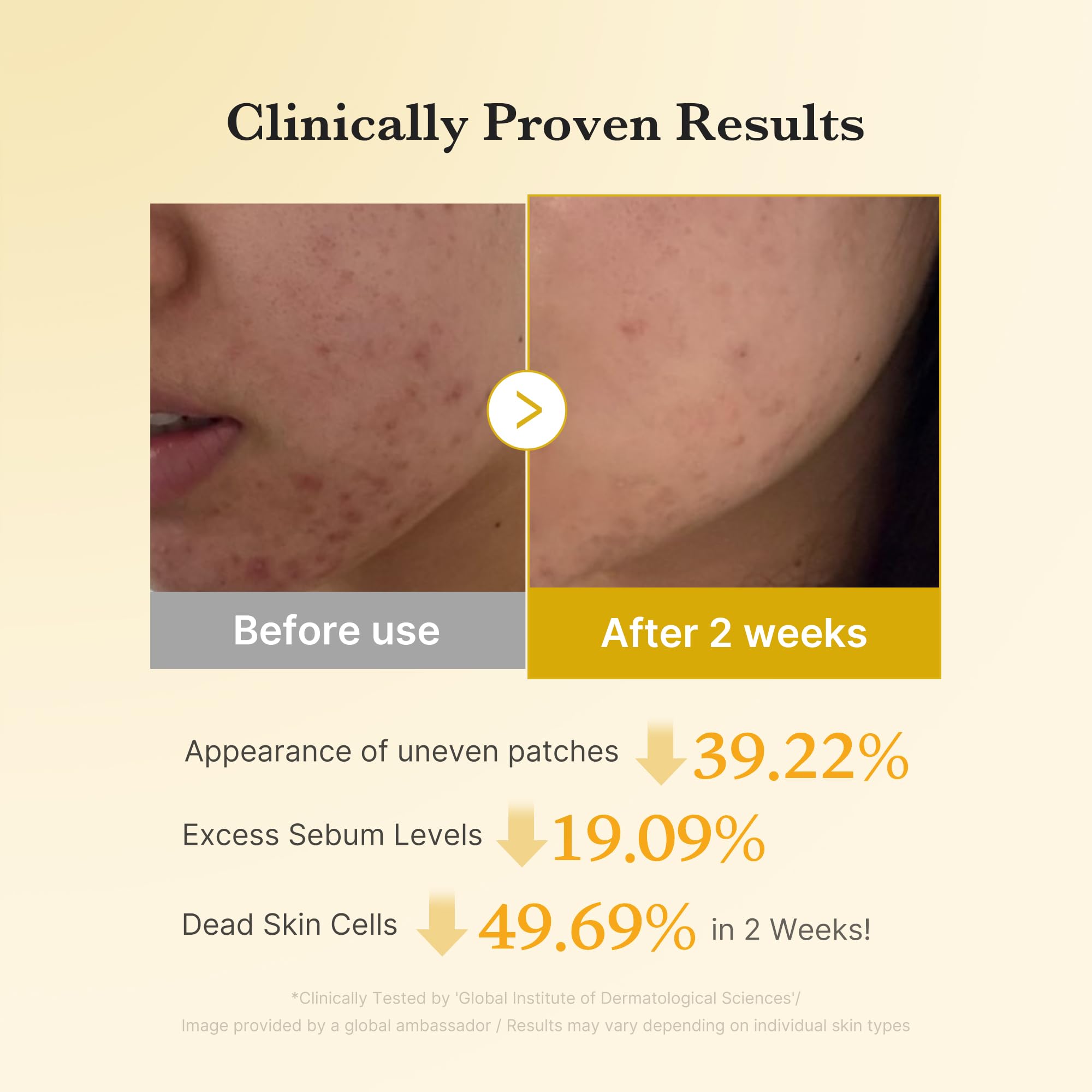 Medicube Kojic Acid Turmeric Toner Pad used on face and shoulders for smoothing.