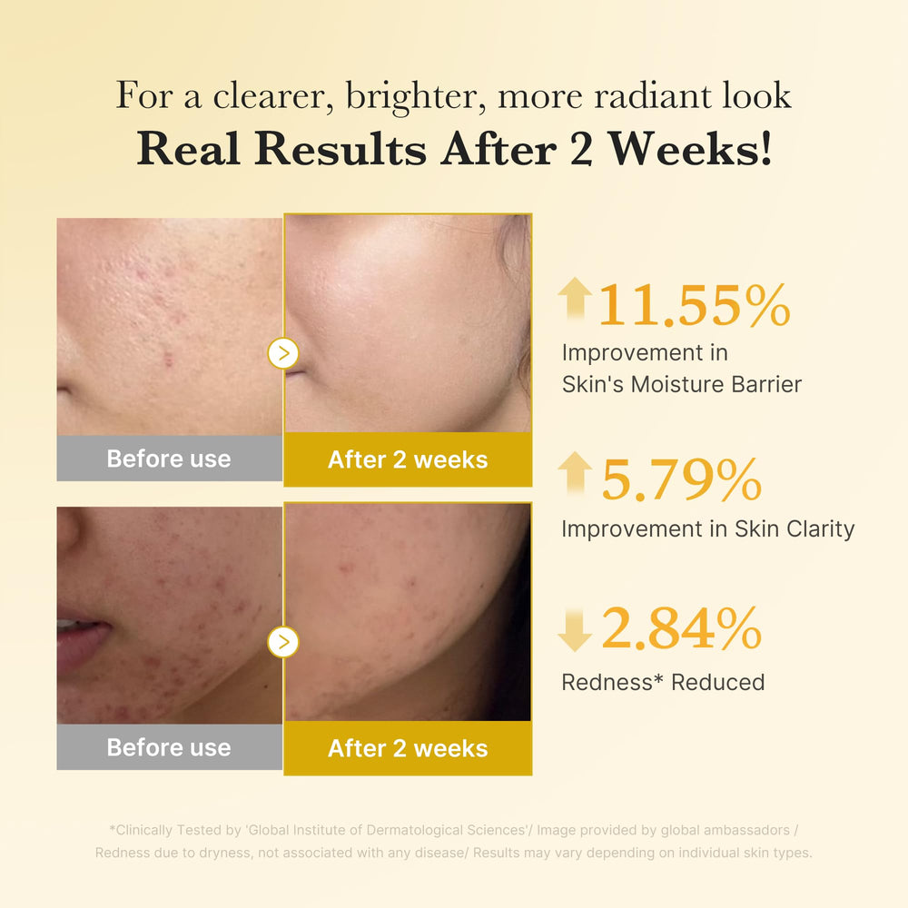 medicube turmeric kojic brightening duo application on skin