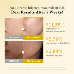 medicube turmeric kojic brightening duo application on skin