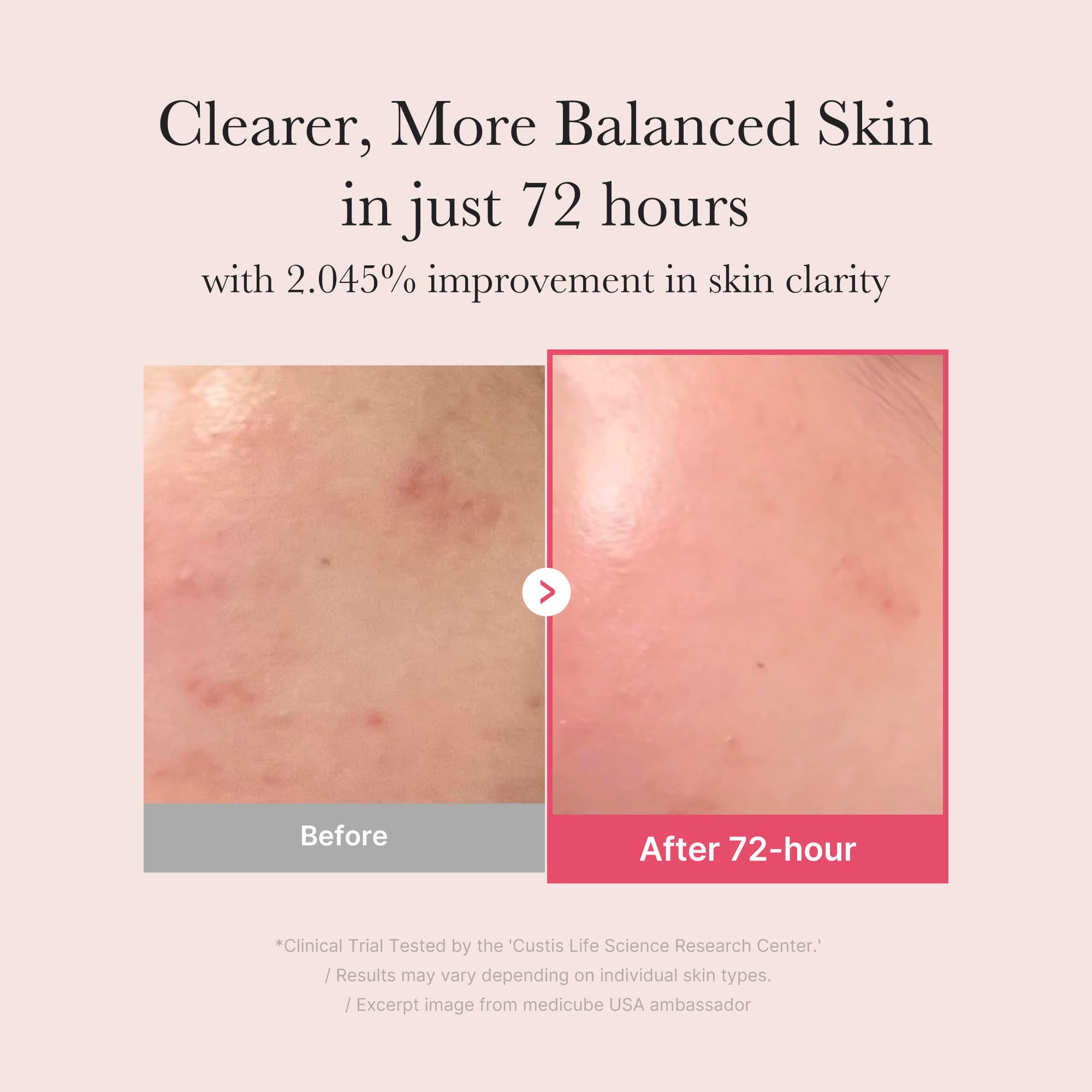 medicube TXA+Niacinamide serum texture closeup showing lightweight formula
