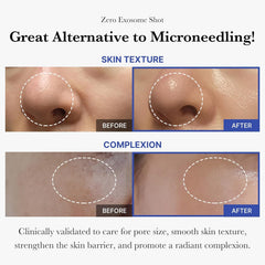 medicube zero exosome shot spicule detail emphasizing micro-needle delivery