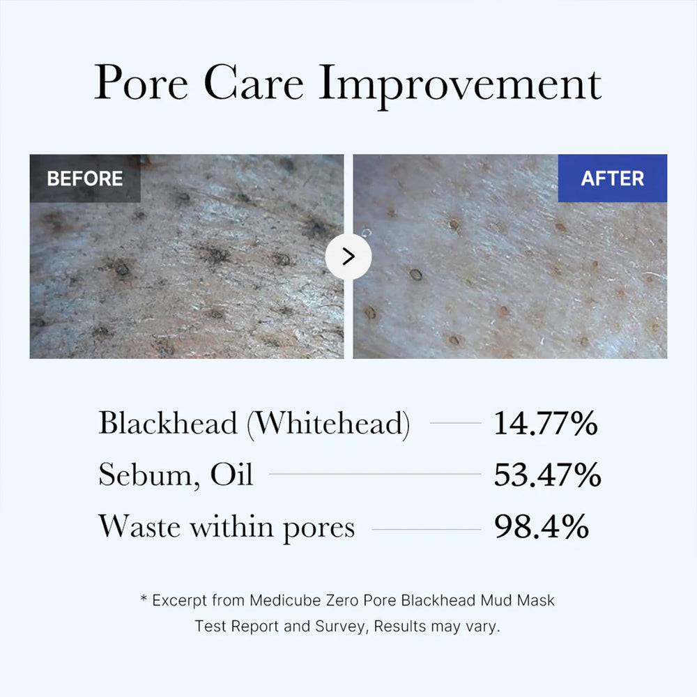 Medicube Zero Pore Mud Mask after use reveals radiant, smoother skin texture.