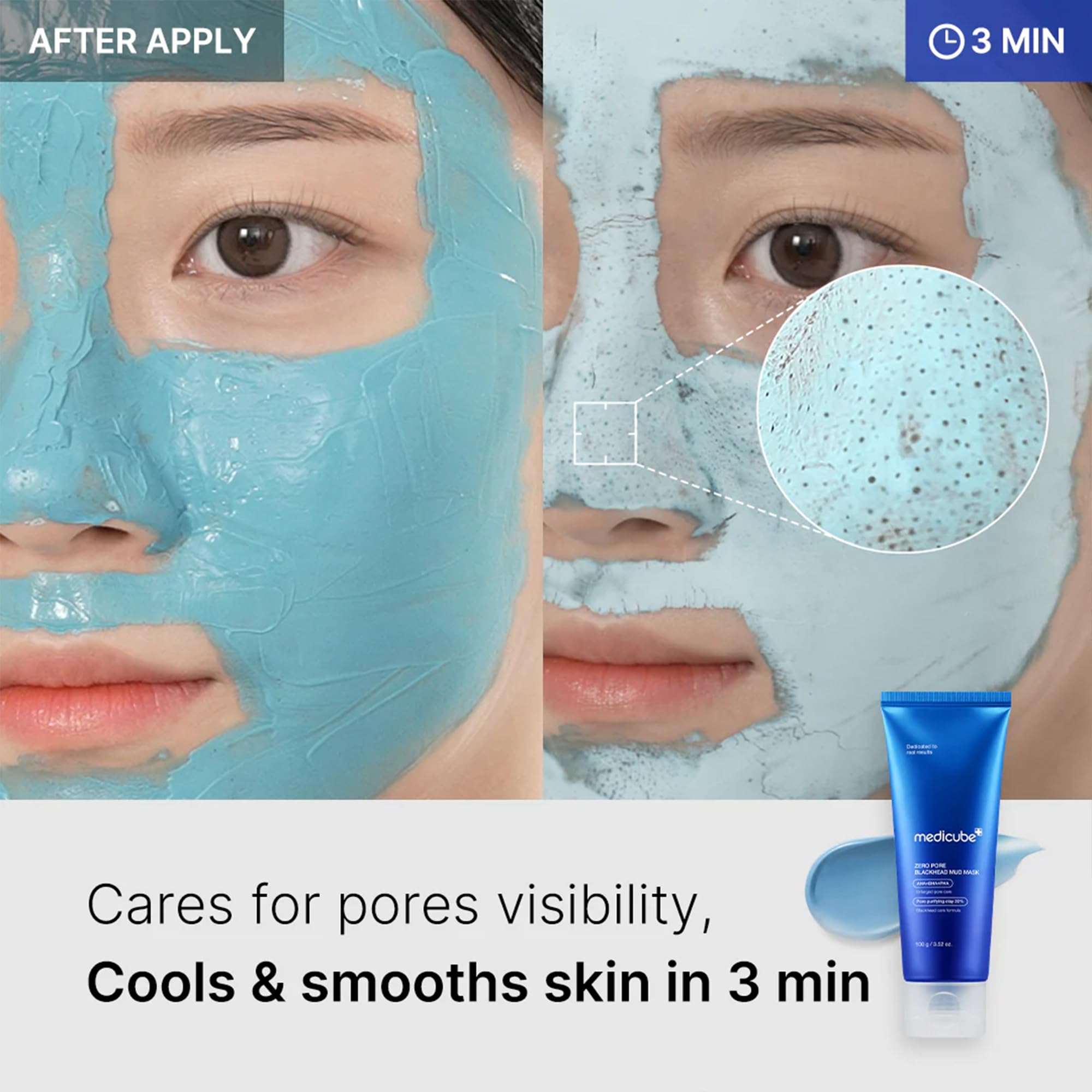 Medicube Zero Pore Mud Mask texture shows detoxifying clay for clearer complexion.