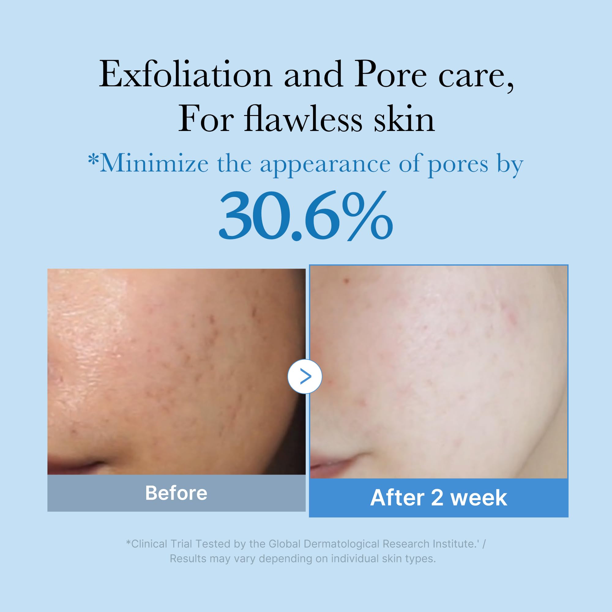 medicube Zero Pore Toner label close-up—AHA/BHA/PHA exfoliation benefits