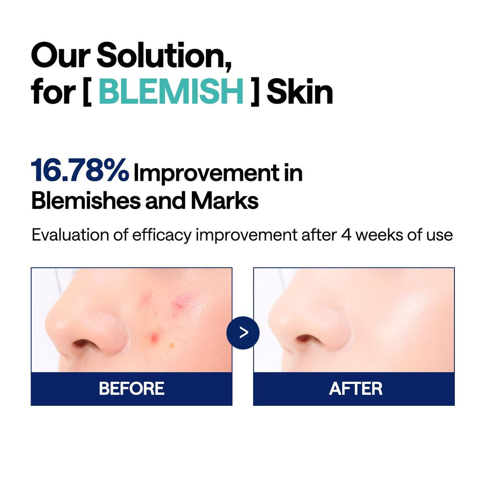 Mediheal Madecassoside blemish pad applied to face showing targeted blemish care