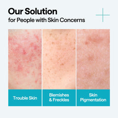 Mediheal Madecassoside Centella Asiatica extract detail focusing on calming skin support.