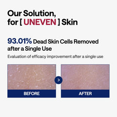 Mediheal Phyto-Enzyme toner pads sebum control close-up demonstrates matte skin effect.