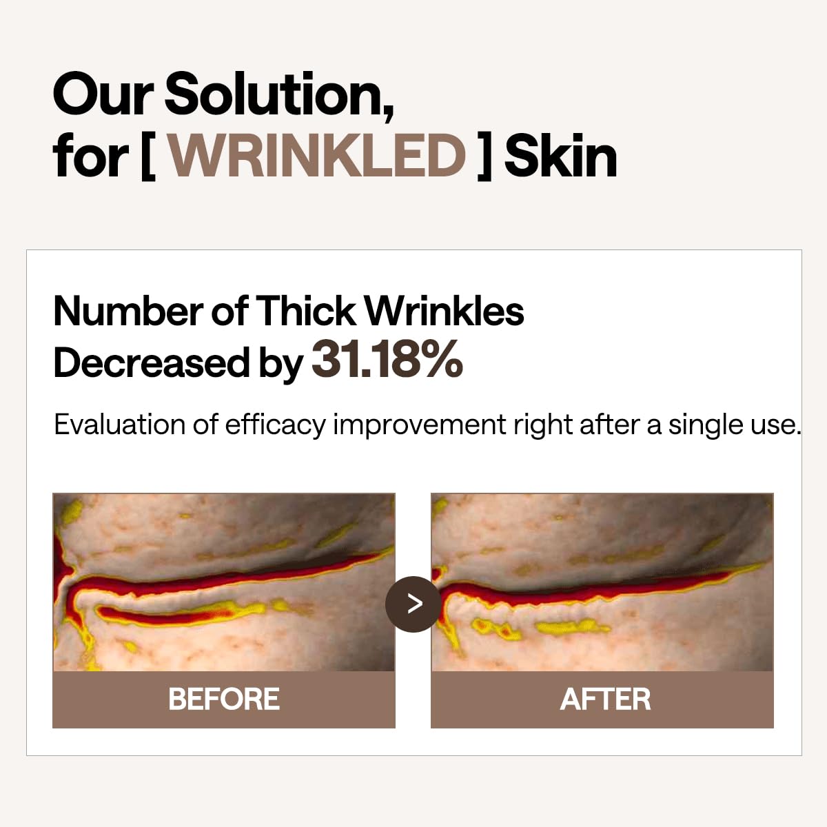Mediheal Retinol Liposome Collagen Complex shown for firmer-feeling under-eye area.