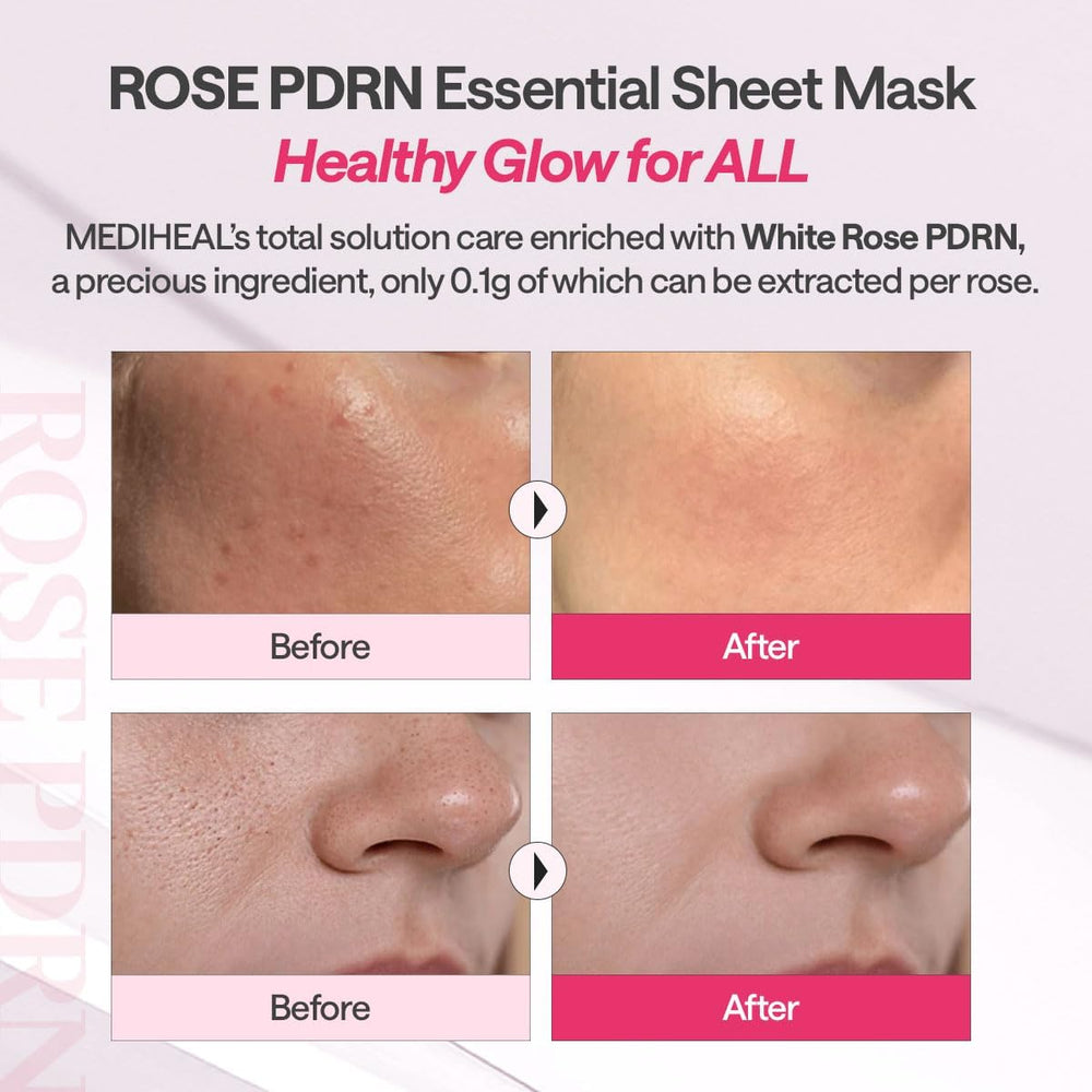 Mediheal Rose PDRN after-use glow illustrating refreshed skin.