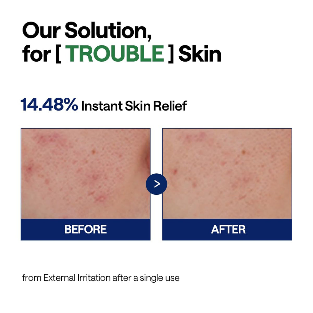 Mediheal Teatree Serum dermatologically tested in Germany ensures safe daily use.