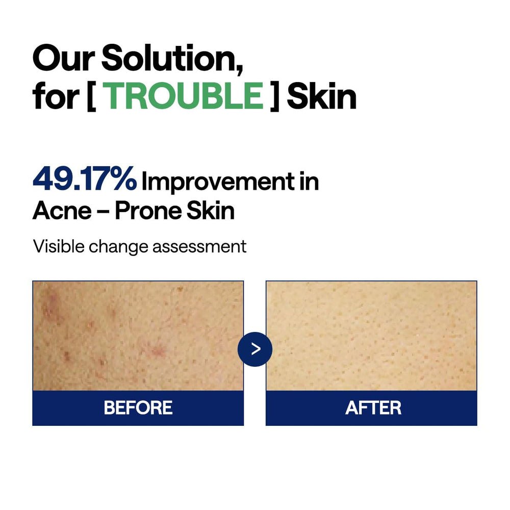 Mediheal Teatree Trouble Pad gauze texture signals breathable daily use.