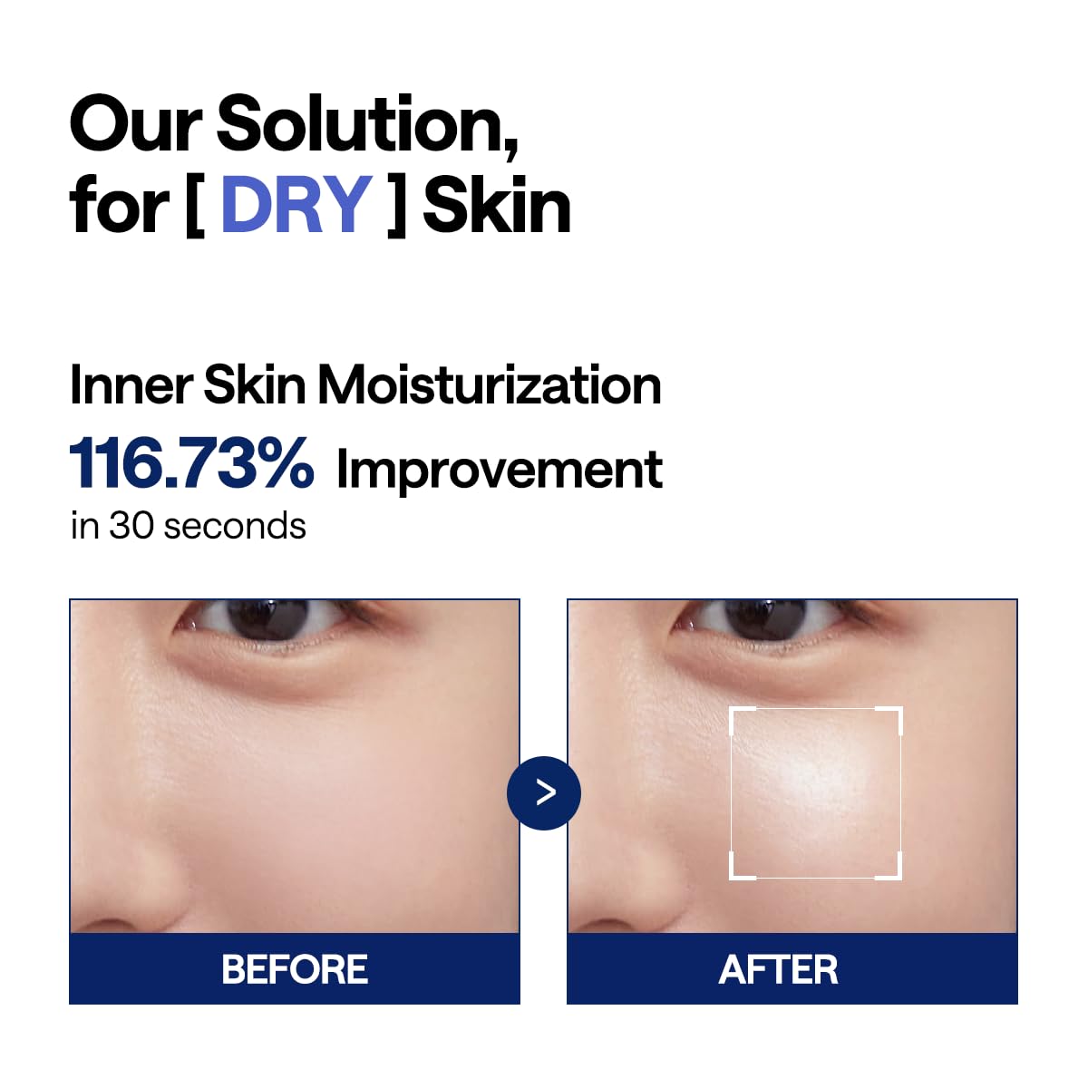 Mediheal Watermide pad displaying its cooling surface on skin