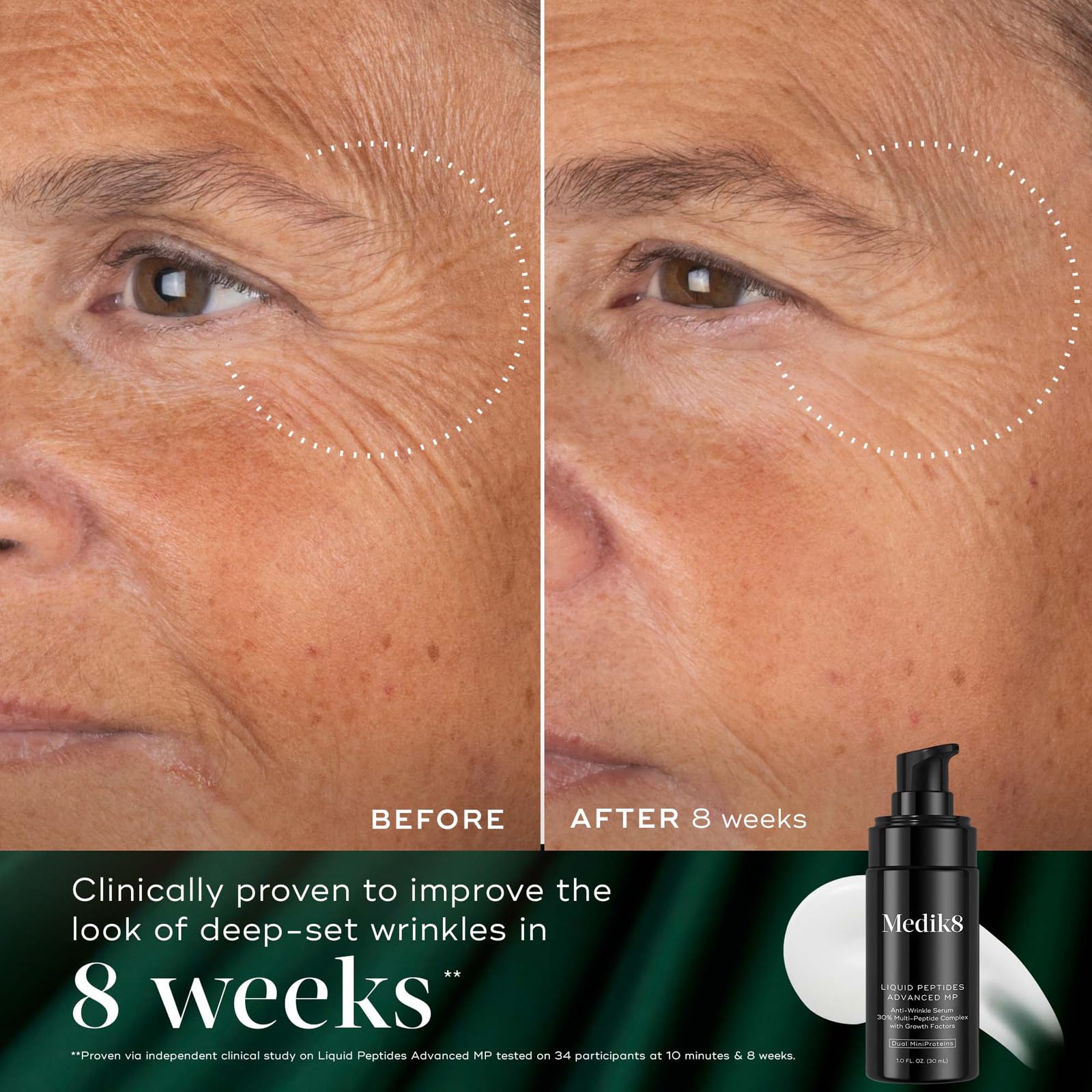 Medik8 Ceramide Face Moisturizer jar with overnight hydration promise.