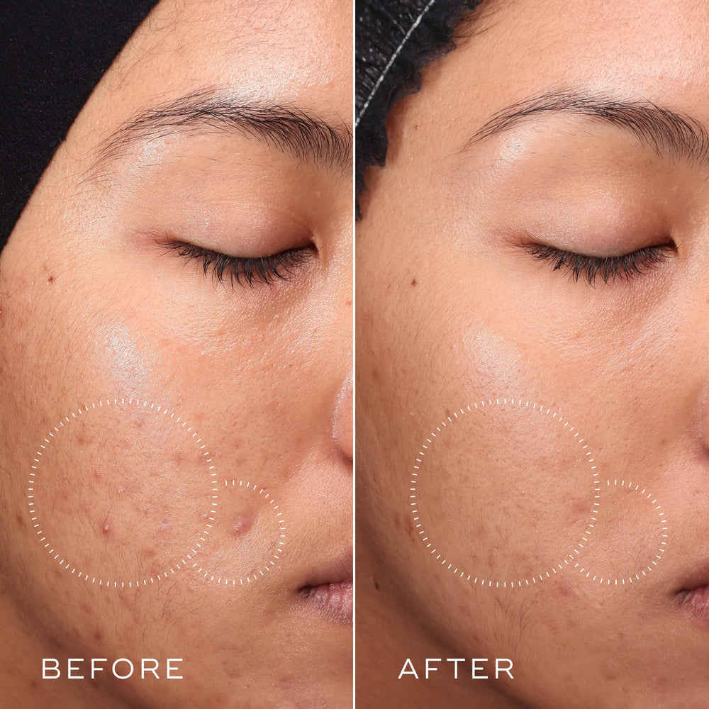 Medik8 Press and Clear texture closeup shows refreshing, non-irritating exfoliation.