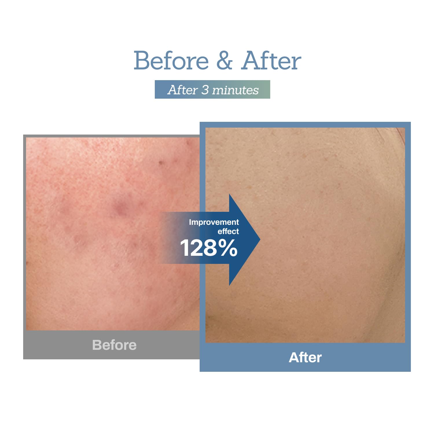 MEDITHERAPY Blue Centella Calming Cream ingredients blue tint illustrates deep recovery potential