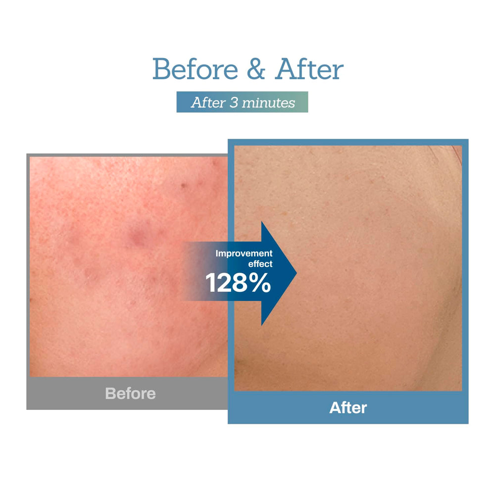 MEDITHERAPY Blue Centella Calming Cream ingredients blue tint illustrates deep recovery potential