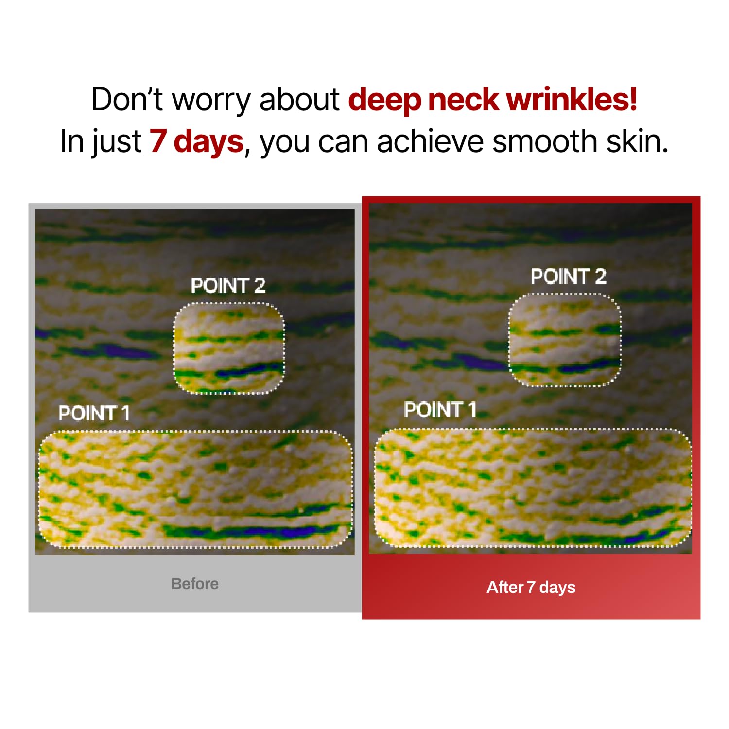 Meditherapy facial roller use demonstrates enhanced absorption and smoother neck lines