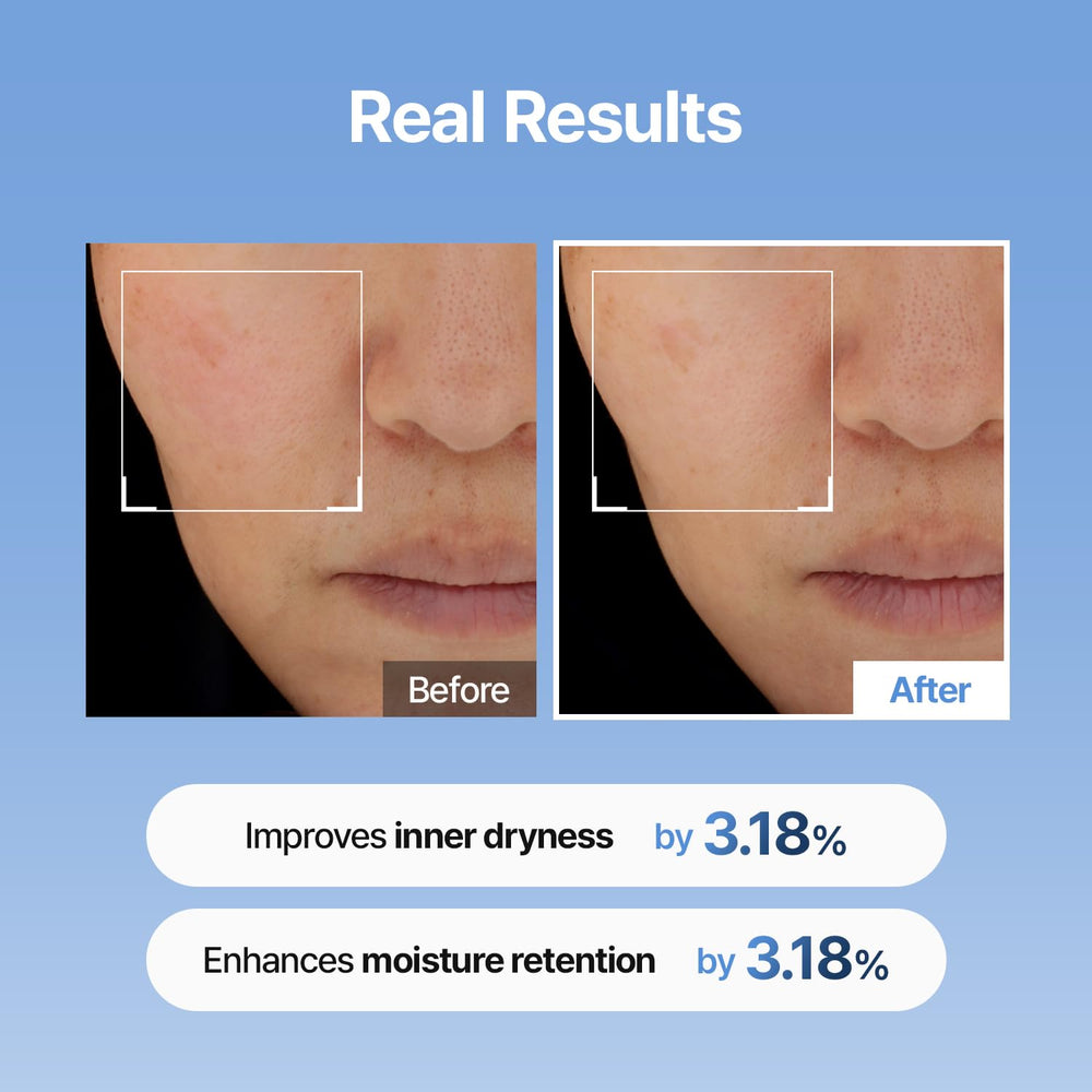 Meditherapy Hyaluronic Acid Serum XXL watery-texture highlights quick absorption for makeup-ready skin.