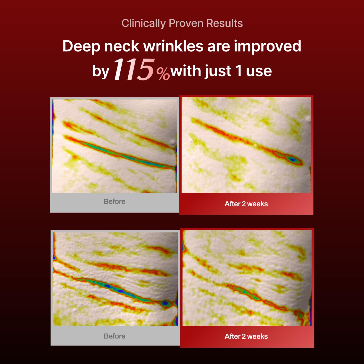 Meditherapy neck-mask-absorption-essence demonstrates deep hydration through generous serum
